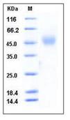 SDS-PAGE - Recombinant Mouse NEGR1 protein (His tag) (AB276884)