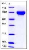SDS-PAGE - Recombinant Mouse NEPH2 protein (His tag) (AB276819)
