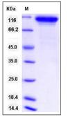SDS-PAGE - Recombinant Mouse Neuroligin 1 protein (His tag) (AB276916), expandable thumbnail