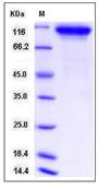 SDS-PAGE - Recombinant Mouse Neuroligin 1 protein (His tag) (AB276916)
