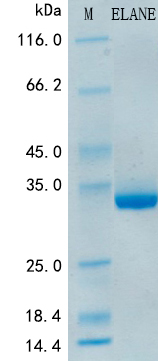 SDS-PAGE - Recombinant Mouse Neutrophil Elastase Protein Standard (His tag) (AB316389), expandable thumbnail