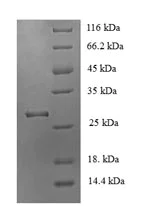SDS-PAGE - Recombinant Mouse Nicotinic Acetylcholine Receptor alpha 1/CHRNA1 protein (His tag) (AB235741)