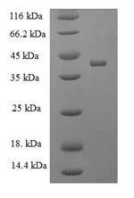 SDS-PAGE - Recombinant Mouse Nicotinic Acetylcholine Receptor alpha 1/CHRNA1 protein (Tagged) (AB235734)