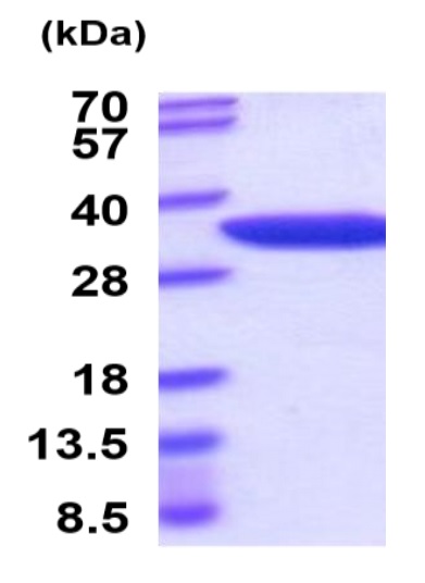 SDS-PAGE - Recombinant Mouse Nmnat1/NMNAT protein (His tag) (AB222977)