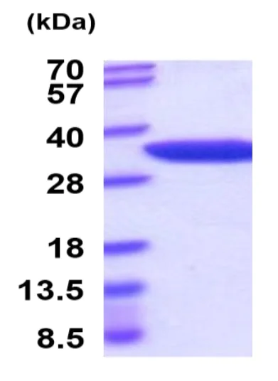 SDS-PAGE - Recombinant Mouse Nmnat1/NMNAT protein (His tag) (AB222977)