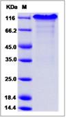 SDS-PAGE - Recombinant Mouse Notch1 protein (Fc Chimera) (AB276893)