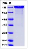 SDS-PAGE - Recombinant Mouse Notch1 protein (Fc Chimera) (AB276893)