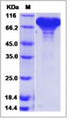 SDS-PAGE - Recombinant mouse NRP2 protein (His tag) (AB277019), expandable thumbnail