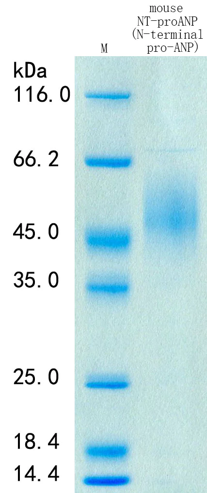 SDS-PAGE - Recombinant Mouse NT-ProANP Protein Standard (AB316437)