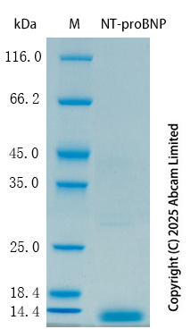 SDS-PAGE - Recombinant Mouse NT-proBNP Protein Standard (AB324499), expandable thumbnail