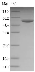 SDS-PAGE - Recombinant Mouse Nucleophosmin protein (Tagged) (AB226265)