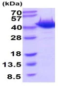 SDS-PAGE - Recombinant Mouse Ogg1 protein (His tag) (AB222985)