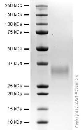 SDS-PAGE - Recombinant Mouse Oncostatin M/OSM protein (AB280335)