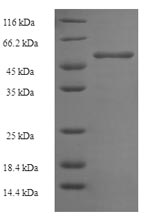 SDS-PAGE - Recombinant Mouse Ornithine Carbamoyltransferase/OTC protein (Tagged) (AB235795), expandable thumbnail