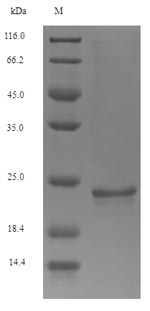 SDS-PAGE - Recombinant Mouse Osteocalcin protein (Tagged) (AB274873)