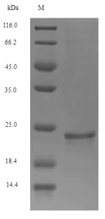 SDS-PAGE - Recombinant Mouse Osteocalcin protein (Tagged) (AB274873)