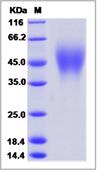 SDS-PAGE - Recombinant Mouse OSTM1 protein (His tag) (AB277009), expandable thumbnail
