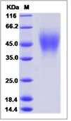 SDS-PAGE - Recombinant Mouse OSTM1 protein (His tag) (AB277009)