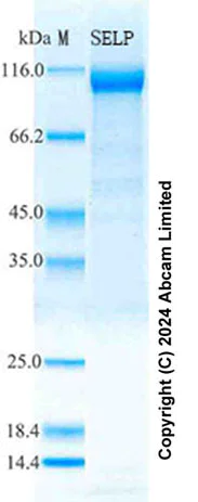 SDS-PAGE - Recombinant Mouse P-Selectin (CD62P) Protein Standard (His tag) (AB316601)