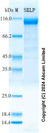 SDS-PAGE - Recombinant Mouse P-Selectin Protein Standard (His tag) (AB316601), expandable thumbnail