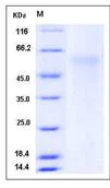 SDS-PAGE - Recombinant Mouse p75 NGF Receptor protein (His tag) (AB276954)