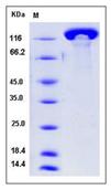 SDS-PAGE - Recombinant Mouse PANG protein (His tag) (AB276963)