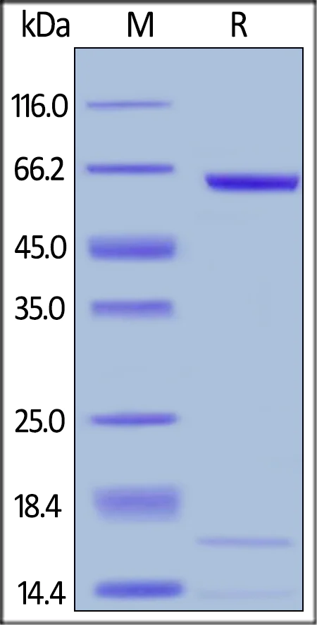 SDS-PAGE - Recombinant mouse PCSK9 protein (AB167759)