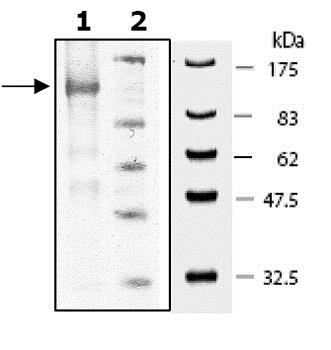 SDS-PAGE - Recombinant mouse PDE5A/PDE5 protein (AB80330), expandable thumbnail