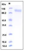 SDS-PAGE - Recombinant Mouse PECAM-1 protein (His tag) (AB276839)