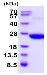 SDS-PAGE - Recombinant mouse Peroxiredoxin 1/PAG protein (Active) (AB219223), expandable thumbnail