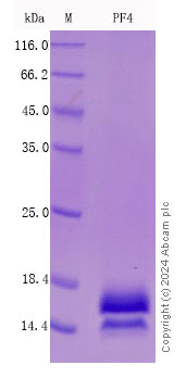 SDS-PAGE - Recombinant Mouse PF4 Protein Standard (His tag) (AB316401), expandable thumbnail