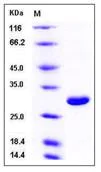 SDS-PAGE - Recombinant Mouse PGP9.5 protein (His tag) (AB276902)