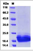 SDS-PAGE - Recombinant Mouse PGRPS protein (His tag) (AB276768)