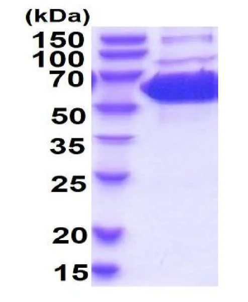 SDS-PAGE - Recombinant mouse PKM2 protein (Active) (His tag N-Terminus) (AB223006)