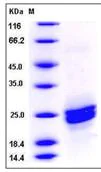 SDS-PAGE - Recombinant Mouse PLA2G12B protein (His tag) (AB276901)