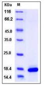 SDS-PAGE - Recombinant Mouse PLA2G1B protein (His tag) (AB276816), expandable thumbnail