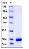 SDS-PAGE - Recombinant Mouse PLA2G1B protein (His tag) (AB276816)