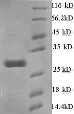 SDS-PAGE - Recombinant Mouse PLA2G5 protein (Tagged) (AB235858)