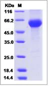 SDS-PAGE - Recombinant Mouse PLA2G7 protein (His tag) (AB277006)
