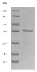 SDS-PAGE - Recombinant Mouse PLET1 protein (Tagged) (AB225971), expandable thumbnail