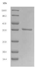 SDS-PAGE - Recombinant Mouse PLET1 protein (Tagged) (AB225971)
