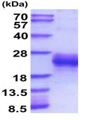 SDS-PAGE - Recombinant Mouse PLGF protein (AB207150)