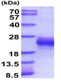 SDS-PAGE - Recombinant Mouse PLGF protein (His tag C-Terminus) (AB207150)