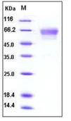 SDS-PAGE - Recombinant Mouse Podoplanin protein (Fc Chimera His Tag) (AB276802)