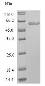SDS-PAGE - Recombinant Mouse PPAR gamma protein (His tag) (AB236330)