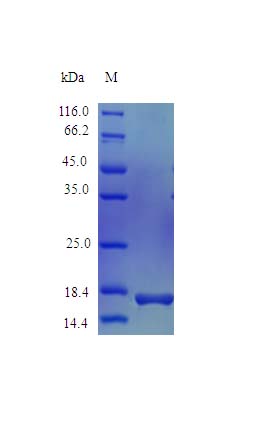 SDS-PAGE - Recombinant mouse Prolactin/PRL protein (Active) (AB243239)
