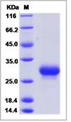 SDS-PAGE - Recombinant Mouse Prostaglandin D Synthase (Lipocalin)/PDS protein (His tag) (AB277004)