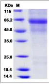 SDS-PAGE - Recombinant Mouse Protein C (His tag) (AB276803)