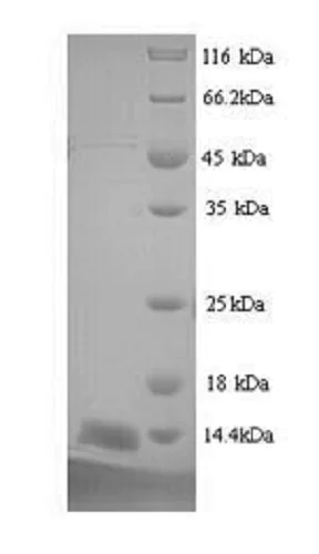 SDS-PAGE - Recombinant Mouse PSCA protein (His tag) (AB241245)