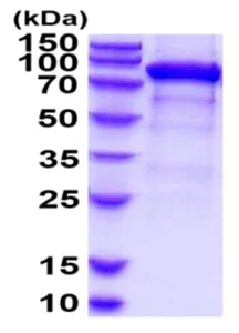 SDS-PAGE - Recombinant Mouse PSMA protein (His tag) (AB219283)